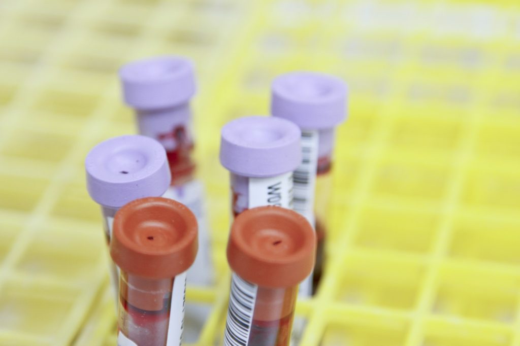 Blood sample tubes in a laboratory rack